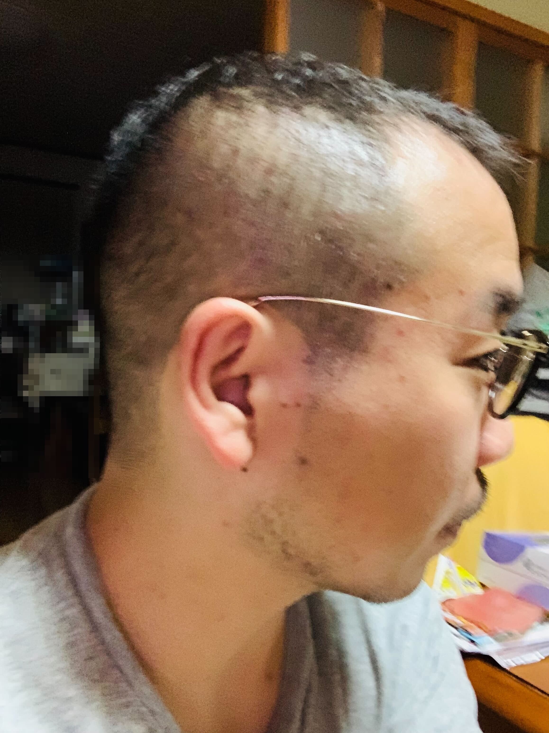 中国製バッテリーで自宅火災 被害男性 アマゾンを提訴 巨大プラットフォーム の責任問う 弁護士ドットコム 中国製バッテリーで自宅火災 被害男性 アマゾンを提訴 巨大プラットフォーム の責任問う 弁護士ドットコム