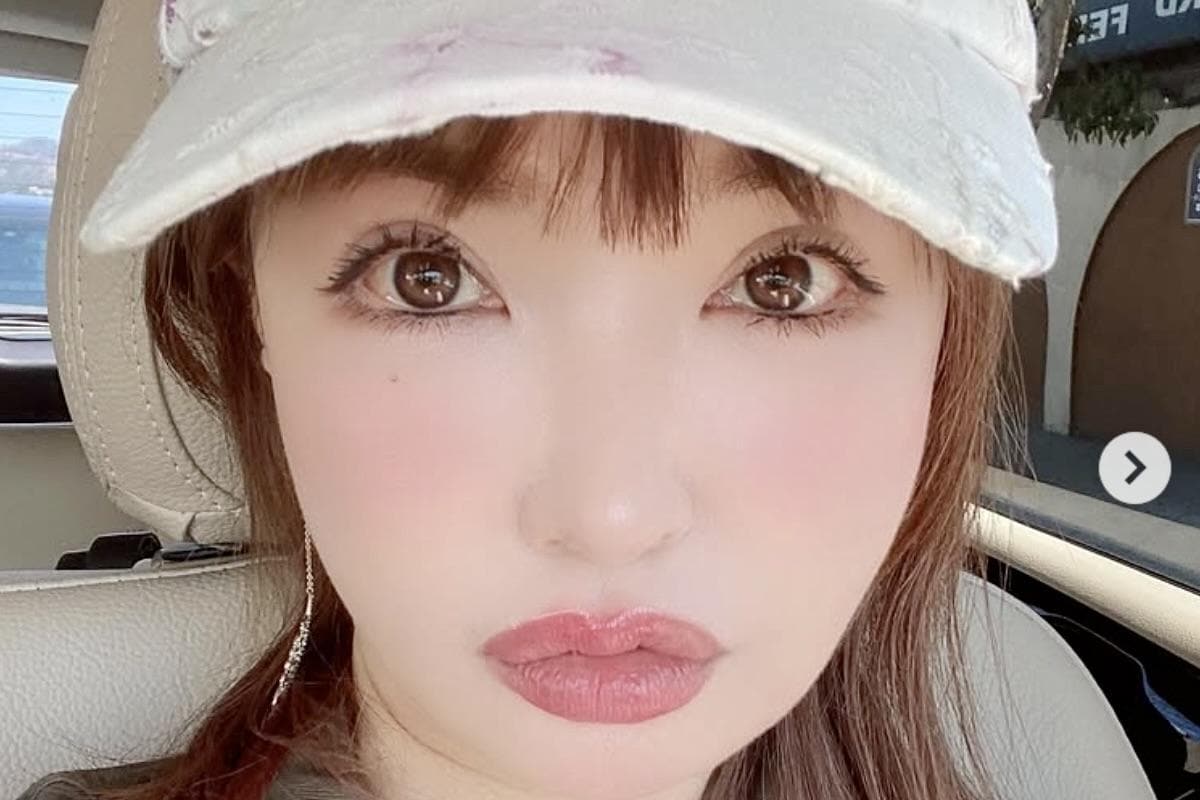 「唇にヒアルロン酸してる」などのコメントが届いたというインスタグラムの投稿（平子理沙さんのインスタグラム）