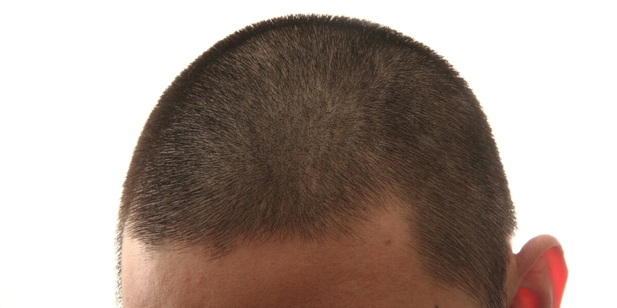 ミスした部下に「俺なら坊主にする」 上司の発言は指導か、パワハラか？